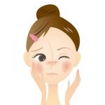 日焼け後のヒリヒリ痛〜い顔のアフターケア方法！化粧水でのおすすめケアも！